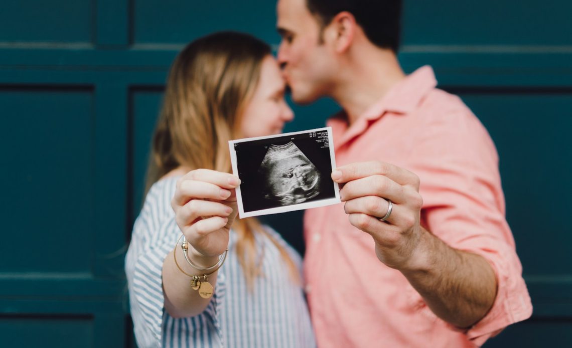 man kissing woman's forehead white holding ultrasound photo