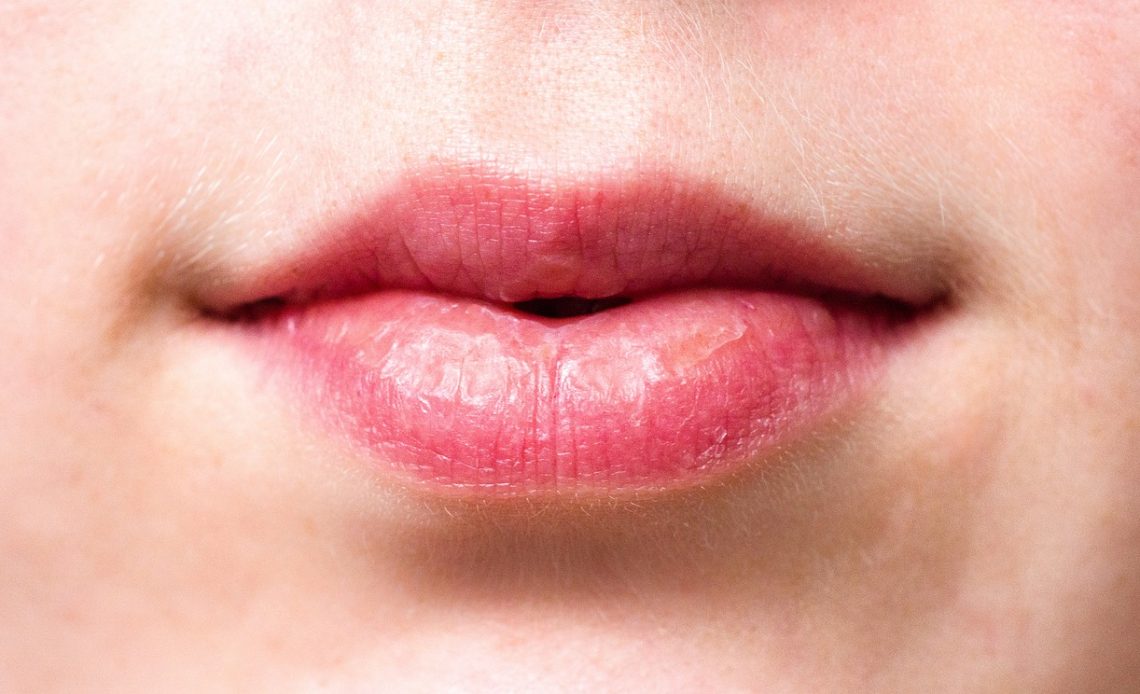 Vrouw die haar droge en pijnlijke lippen aanraakt